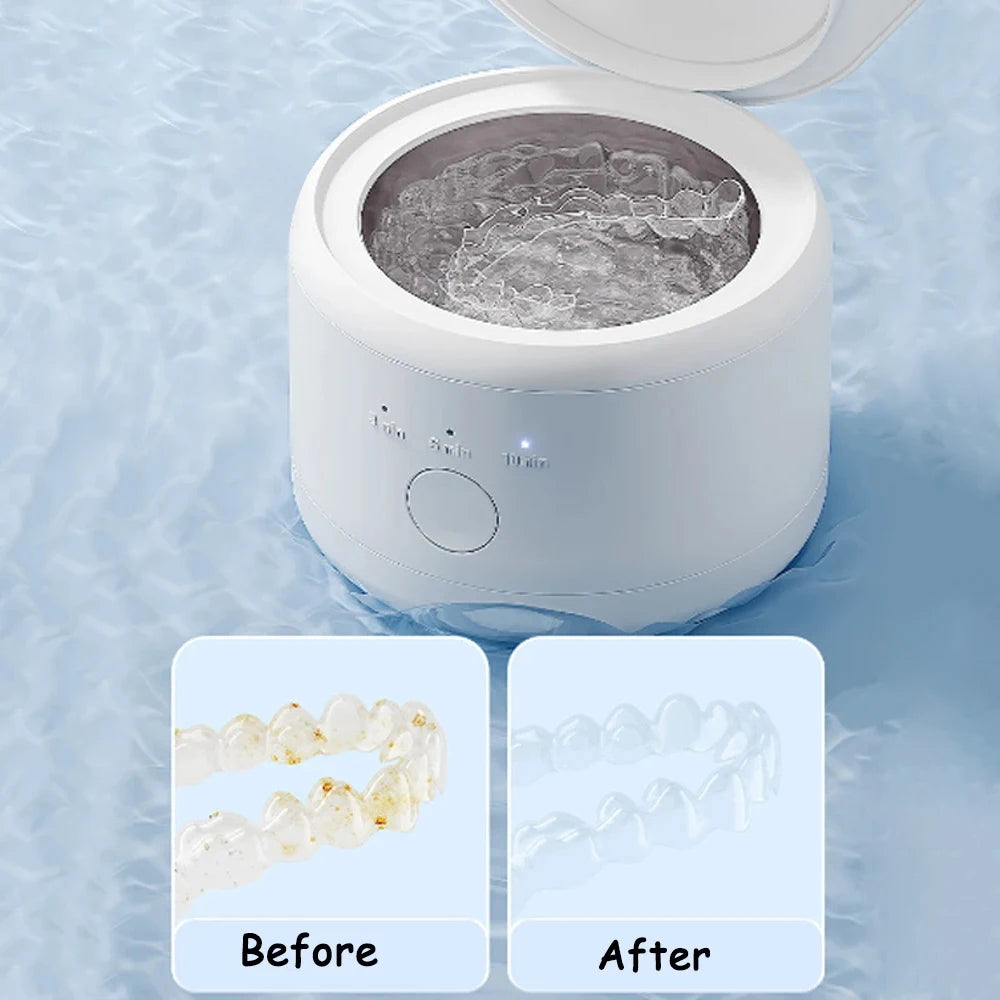 Ultrasonic Retainer Cleaner for Dentures & Aligners
